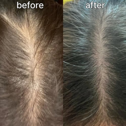 فايف لاب سيروم الشعر وفروة الراس والحواجب 3 حبات *...