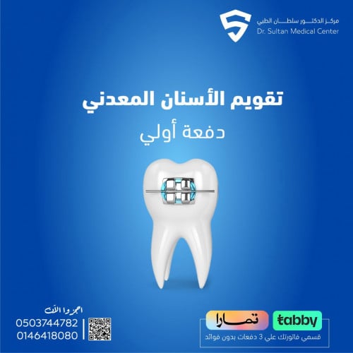 تقويم الأسنان المعدني