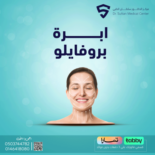 ابرة بروفايلو