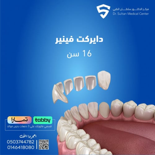 دايركت فينير للفك الواحد