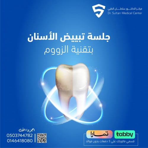 جلسة تبييض الأسنان بتقنية الزووم