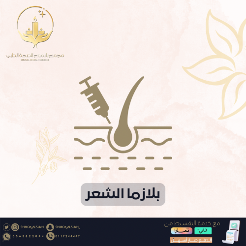 بلازما الشعر