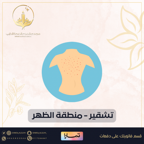 جلسة تشقير - منطقة الظهر