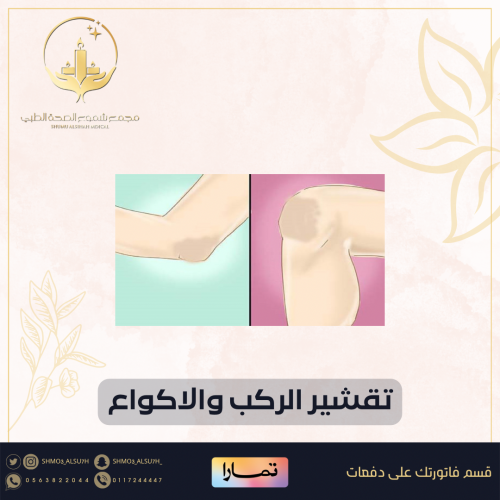 جلسة تقشير - الركب والاكواع