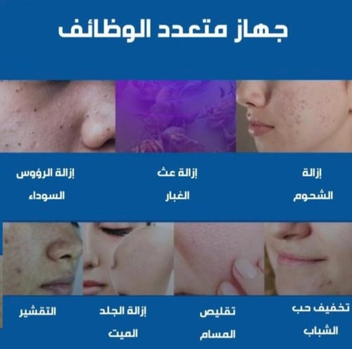 جهاز الهيدرافيشيال المنزلي للعناية بالوجه وتنظيف ا...