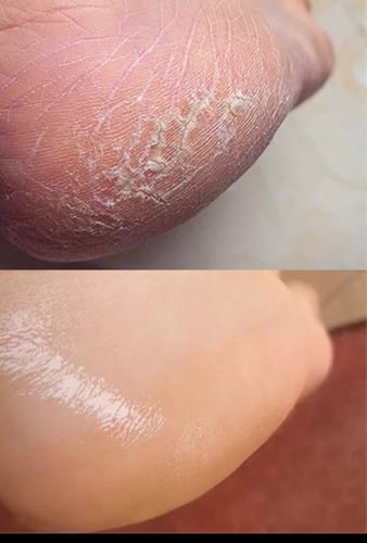 الشراب السحرى