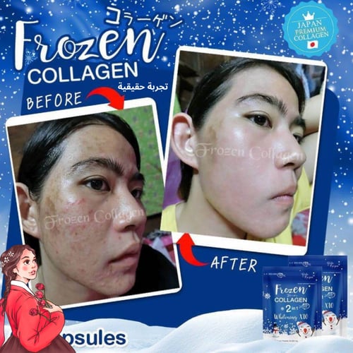 كبسولات فروزن كولاجين للتبيض