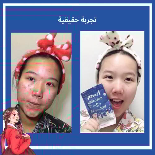 كبسولات فروزن كولاجين للتبيض