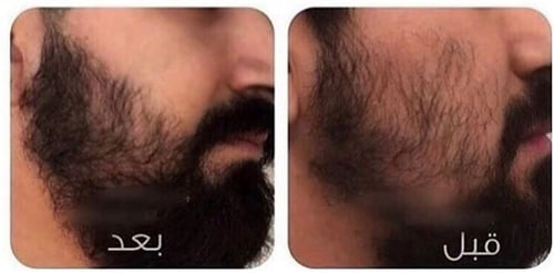 زيت الحشيش الافغاني الخام 250مل مع علبه توزيع هديه