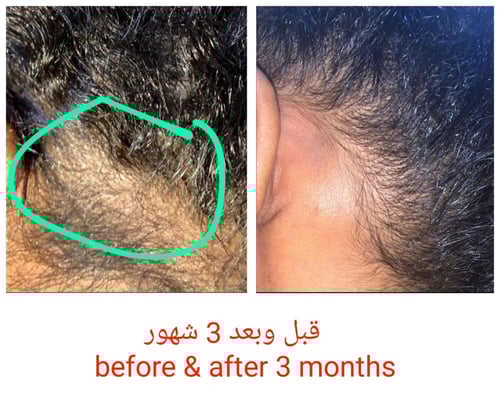 نواتي الإصدار الاول