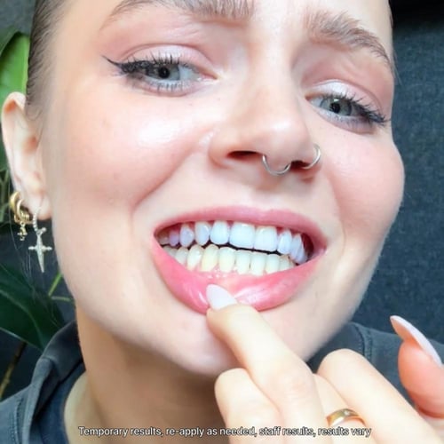 V34 Whitening Strips