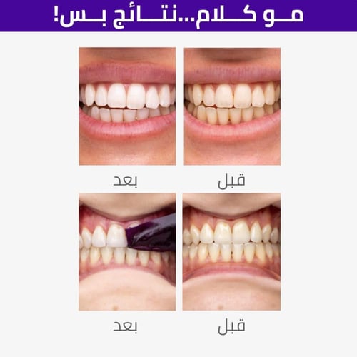 V34 Whitening Strips