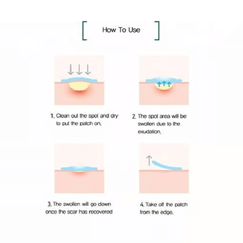 لصقات تغطية الحبوب و الاثار 18 قطعة 18 مقاس مختلف...