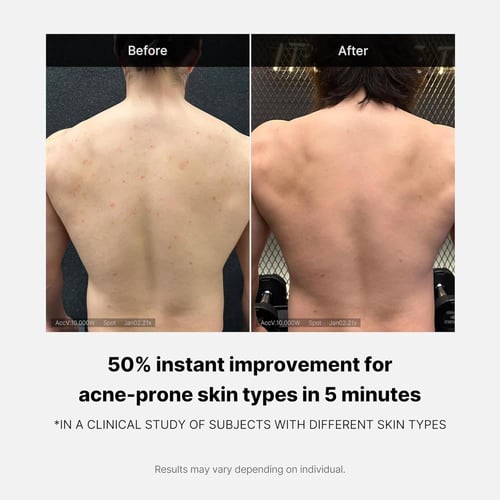 غسول الجسم المقشر للبشرة المعرضة لحب الشباب 400مل...