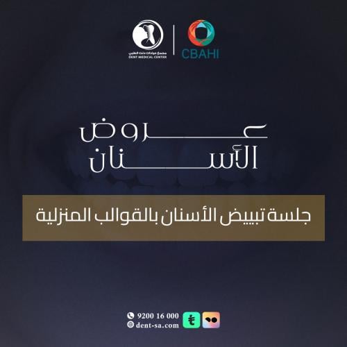 جلسة تبييض الأسنان بالقوالب المنزلية