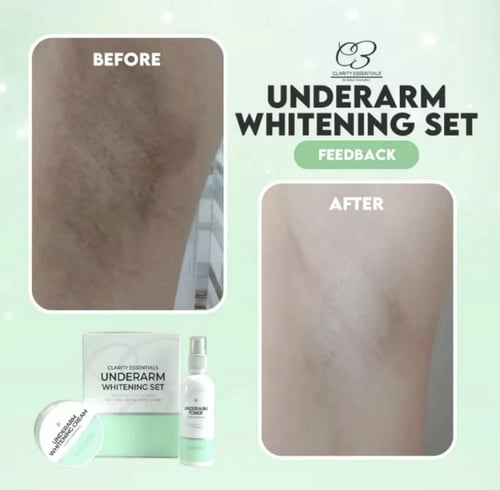 Clarity Essentials Underarm Whitening set