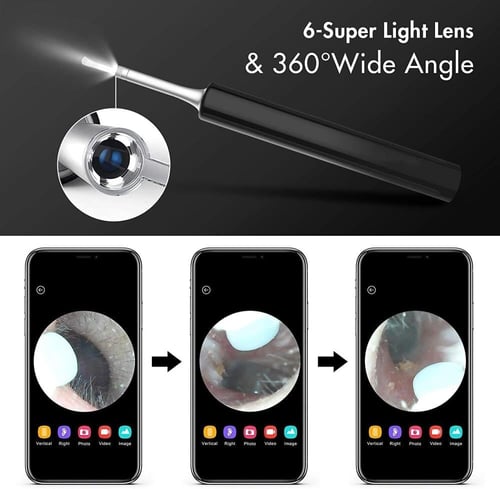 مجموعة إزالة شمع الأذن بالكاميرا