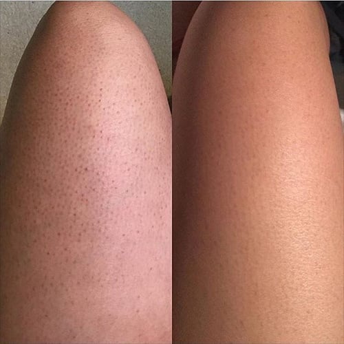 سكرب فرانك اورجنالfrank original scrub