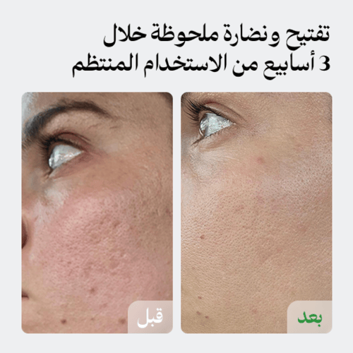 مقشر التفتيح والنضارة