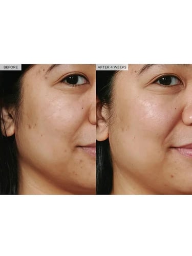 تسليط الضوء على مصل إكلات 40 مل قطرات الندى نياسين...