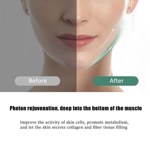 جهاز تنحيف الوجه بالإضاءة