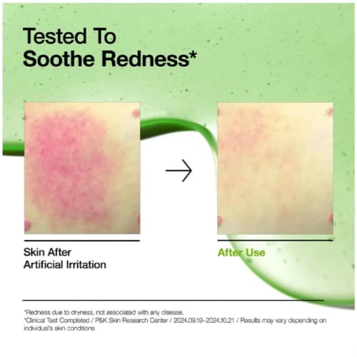 أنوا - سيروم أزيلايك أسيد 10% وهيالورون لتهدئة الا...