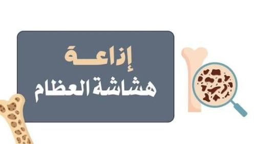 إذاعة عن هشاشة العظام