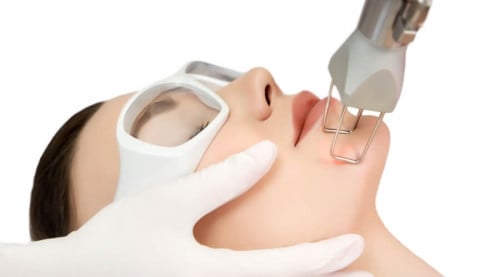 جلسة فركشنال واحدة