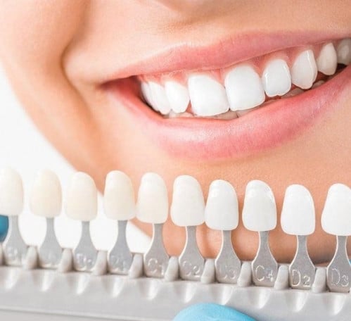 تركيبات الزيركون 16 سن