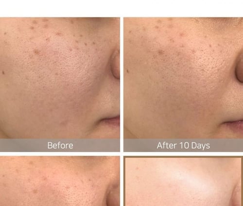 تونر فيتامين سي من سوم باي مي - 200 مل