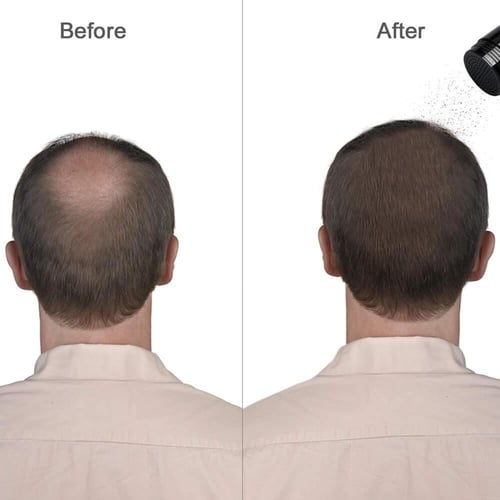 ديكسي الياف بناء الشعر 22 جرام ، بني غامق