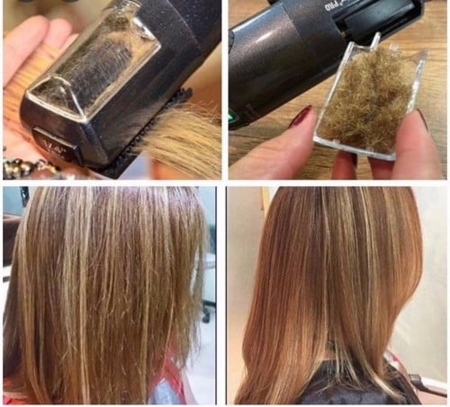 ازاله تقصف شعرطويل