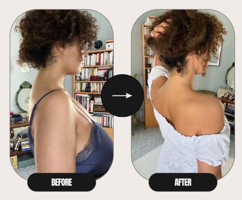 برنامج علاج التحدب بشكل جذري