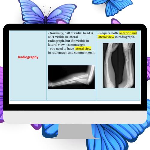 Monteggia + Ghaliazi fracture