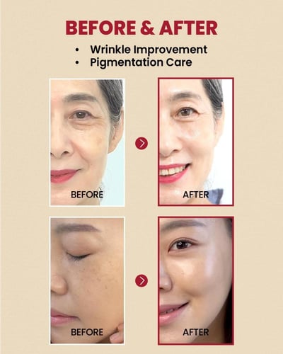 سيروم سيول 1988 بالريتينال والجينسنغ الأسود من كي...