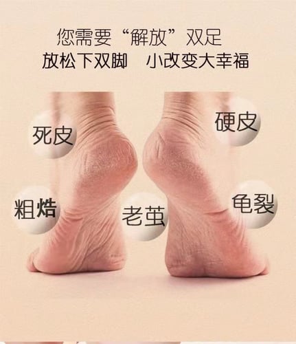 جهاز تقشير القدم القابل للشحن مع رأس إضافي