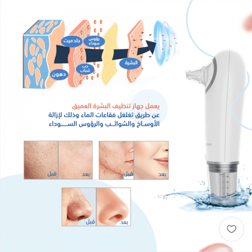 جيڤما جهاز الفيشل المنزلي لتنظيف البشرة العميق واز...