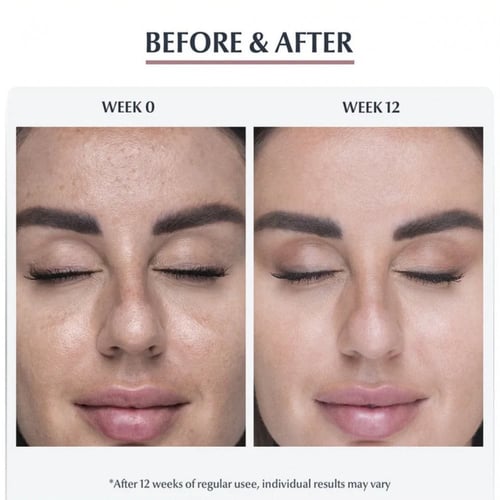 يوسيرين بيغمنت بيرفيكتور رغوة تنظيف البشرة لمكافحة...