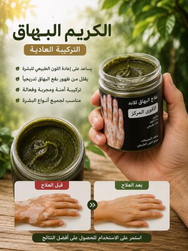 البهاق العبوه الكبيره