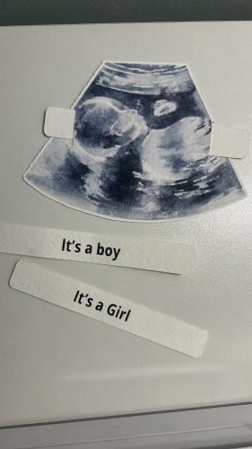 تحديد جنس البيبي