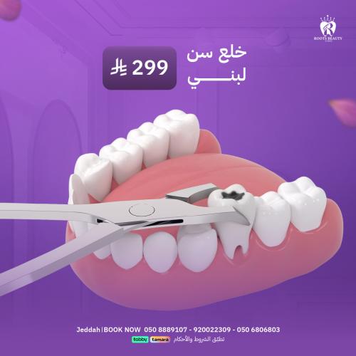 خلع سن لبني