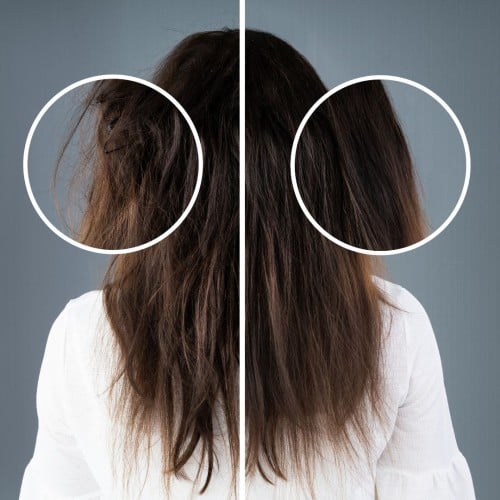 معالج كولاجين للشعر الوسط Collagen Medium hair