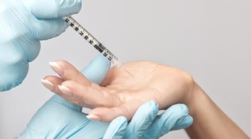 Botox for excessive sweating