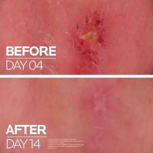 بلسم لاروش بوزيه سيكابلاست المرمم للجلد 40 مل