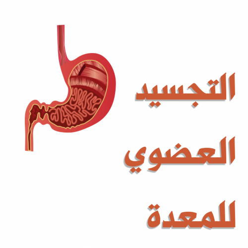 جلسة تحرير المعدة