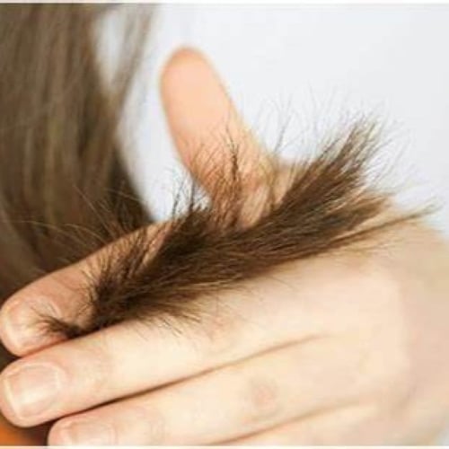 إزالة تقصف شعر