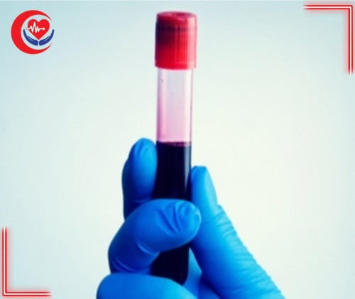 تحليل دم + علاجات