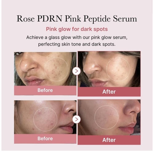 ميديكيوب سيروم بي دي آر إن الوردي 10 عبوات × 1.5 م...