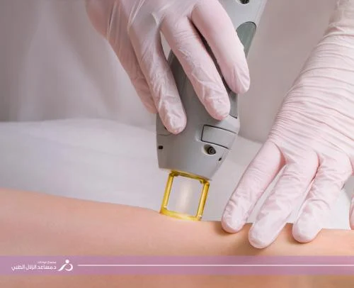 فل بدي للنساء بدون تجهيز