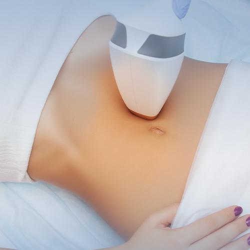 ليزر خط السرة للنساء